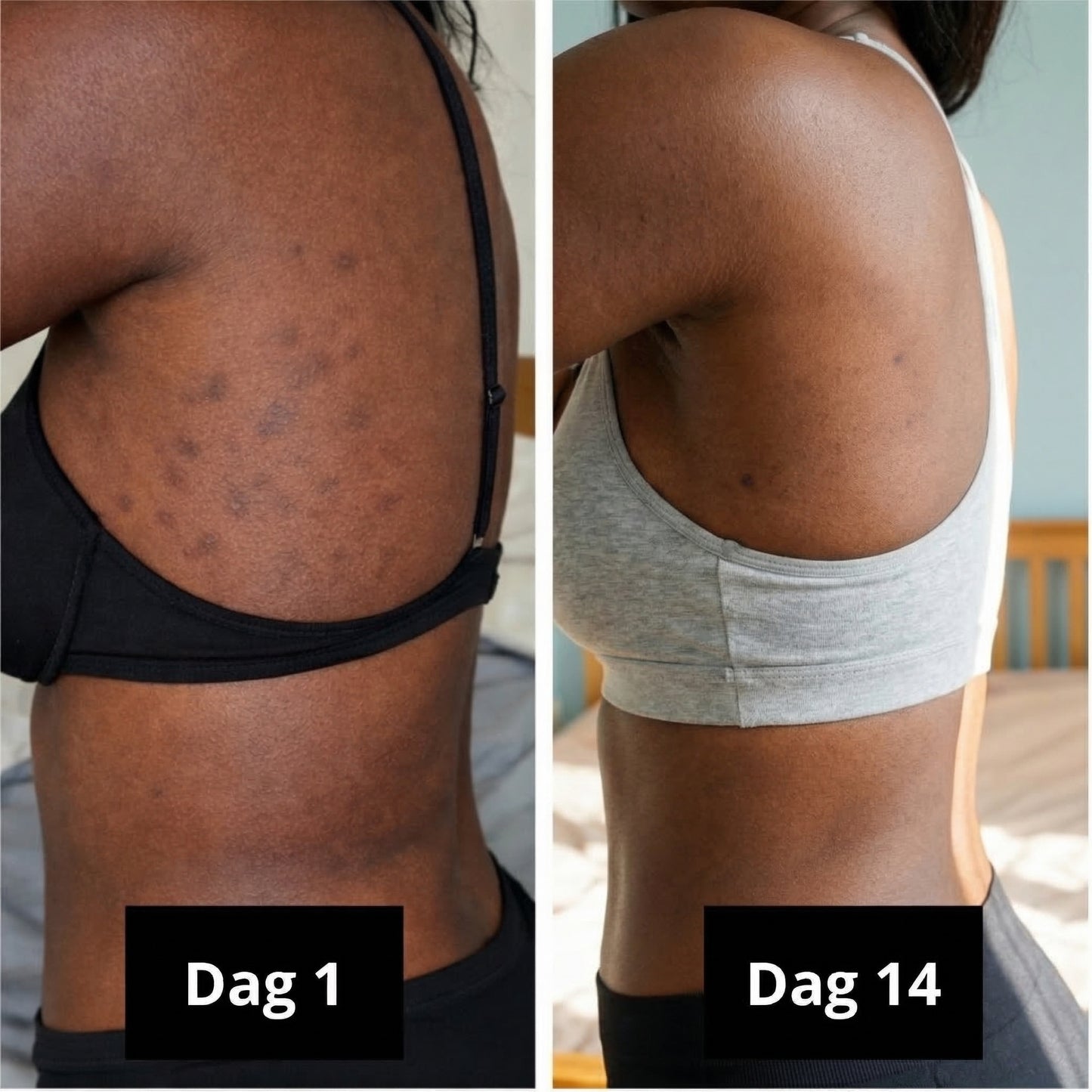 Biologische Kurkuma zeep | Vermindert zichtbaar pigmentvlekken & acne